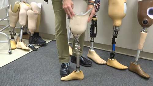 康复课程 6 膝离断假肢