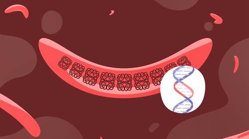 基因治疗与镰刀型细胞贫血病